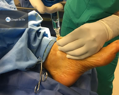 Concentrado de c&eacute;lulas madre Dr Masaragian