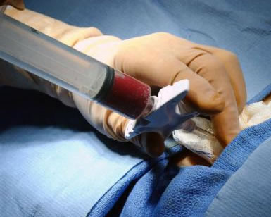 Concentrado de c&eacute;lulas madre Dr Masaragian